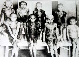 00010_Bambini sottoposti a sevizie nei campi di sterminio nazisti