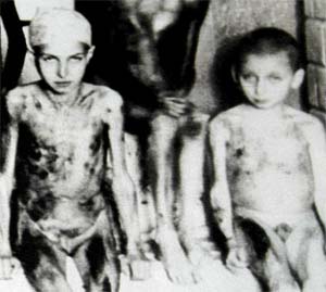 00011_Bambini sottoposti a sevizie nei campi di sterminio nazisti